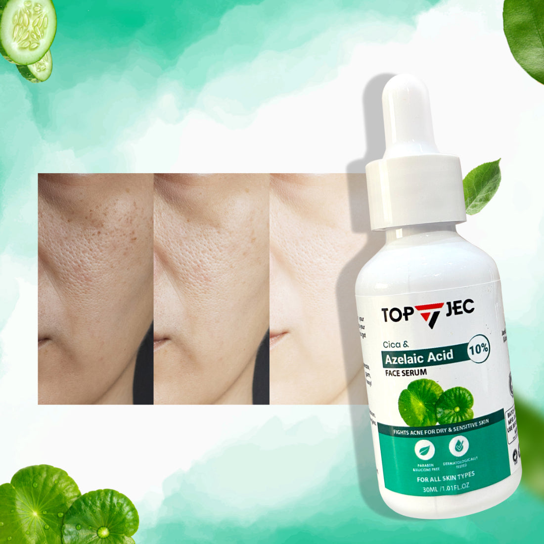 TOPJEC AZELAIC ACID FACE SERUM