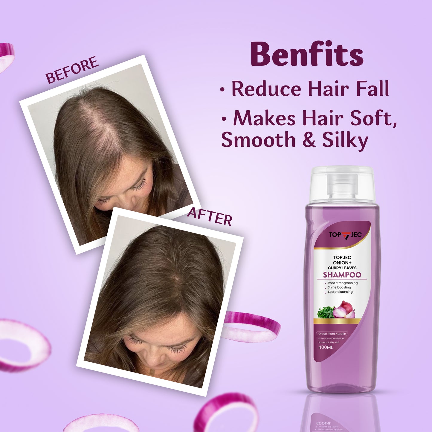 TOPJEC® Onion & Curry Leaves Shampoo – Hair Fall & Dandruff Control